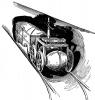 iiii3-ffffff3-eeeeee3_t1.jpg